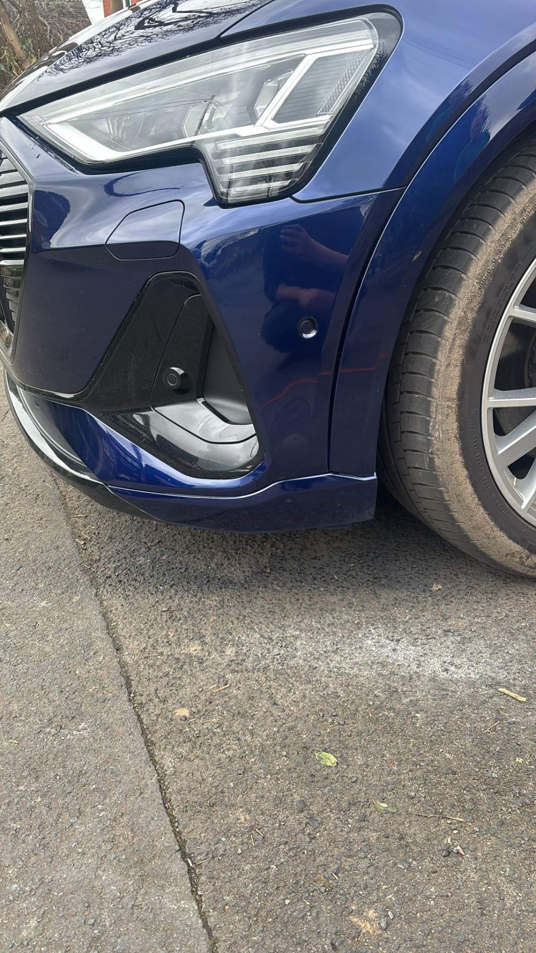 Dents after