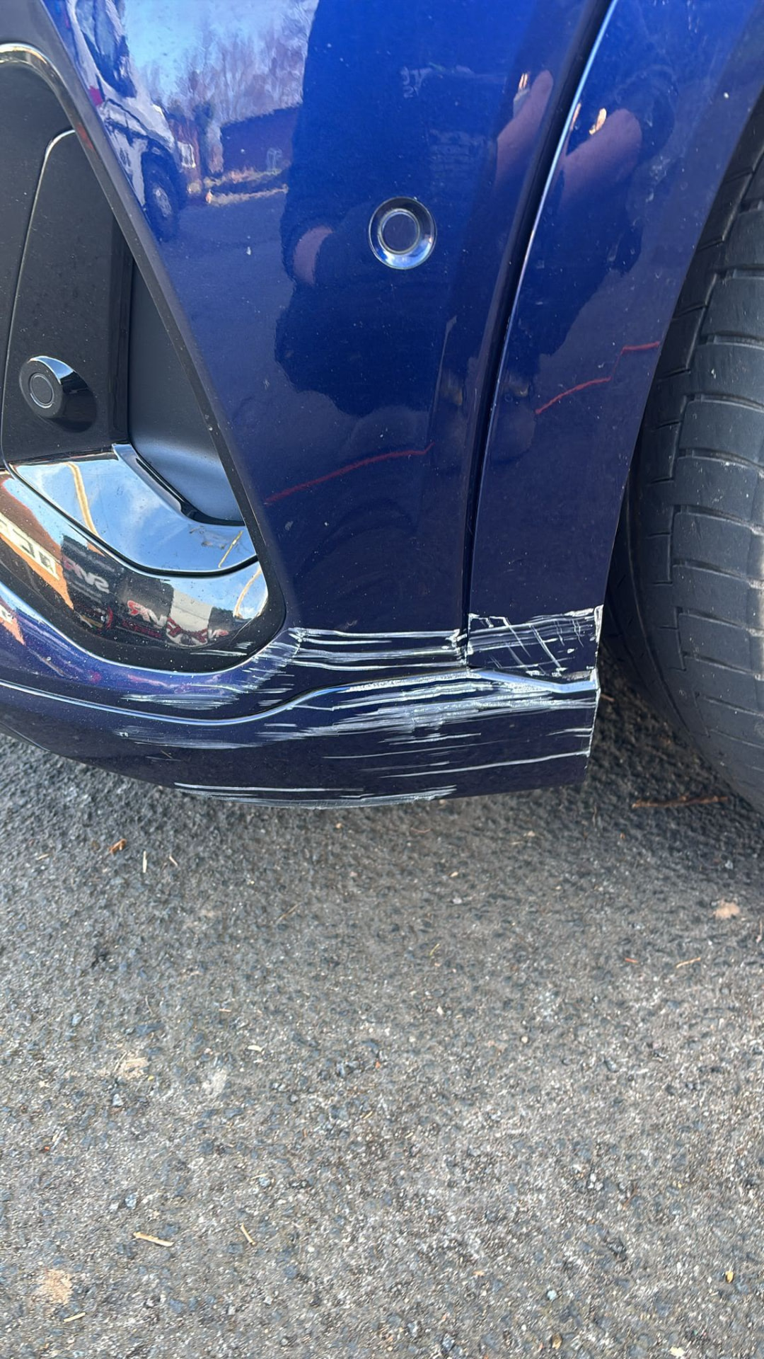 Dents before